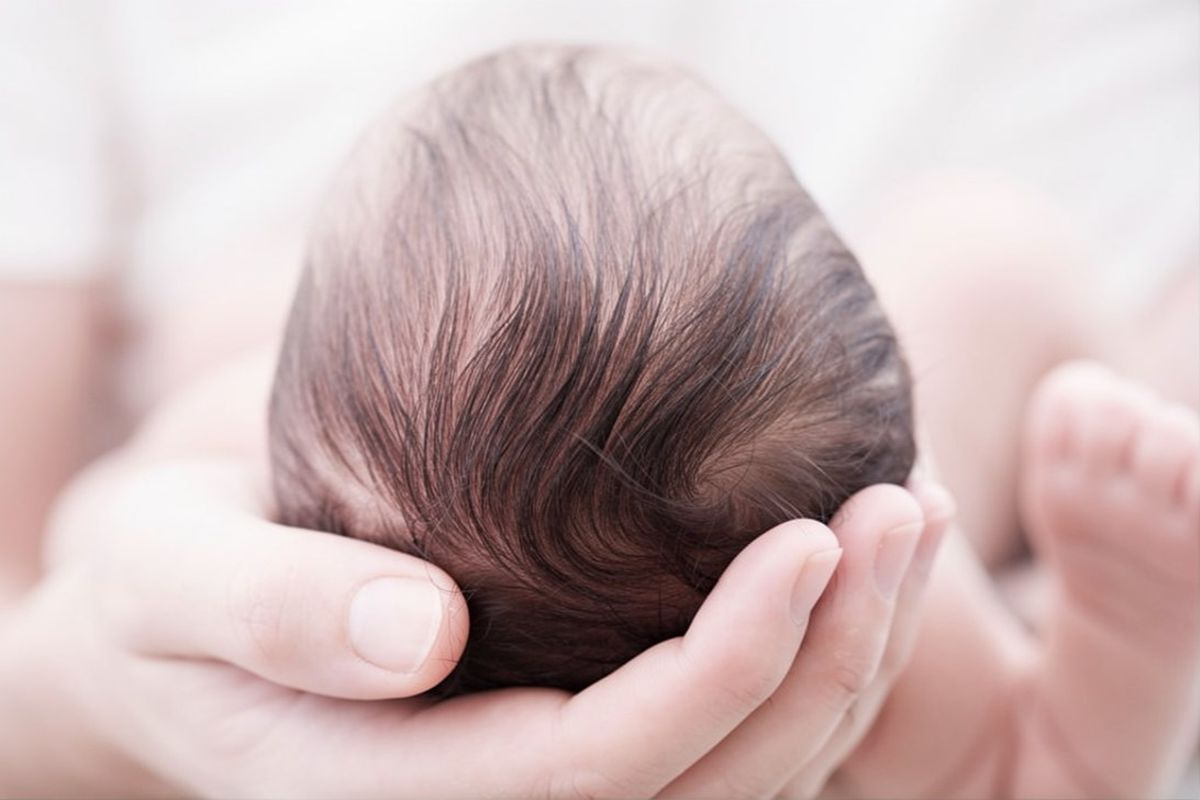 cradle-cap